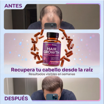 CapilFort - Cabello más fuerte desde adentro
